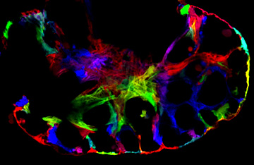 Molecular Genetics of Development and Birth Defects