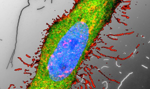 Cytoskelton and Membrane Biology