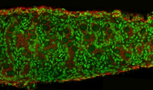 Protein Trafficking and Translation